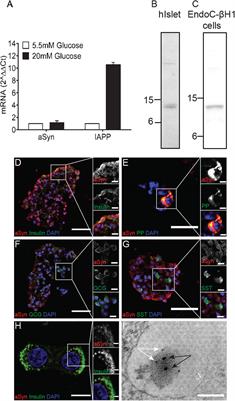 Studies on alpha-synuclein and islet amyloid polypeptide interaction